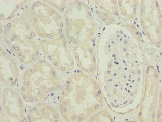 MRPL49 Antibody