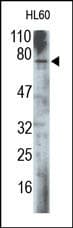 MEN1 / Menin Antibody