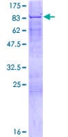 Human FANCE Protein (Recombinant GST)