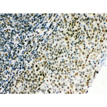 Polyclonal Rabbit anti-Human CTBP1 / CTBP Antibody (aa409-440, IHC, WB)