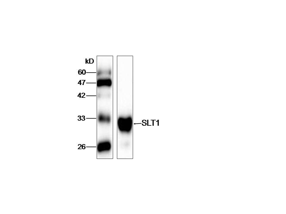 Monoclonal Mouse anti-E. coli Shiga-Like Toxin 1 Subunit A Antibody (aa17-244, WB)