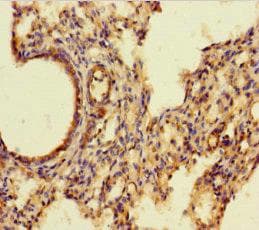 AIF1 / IBA1 Antibody (aa2-147)