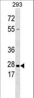 Polyclonal Rabbit anti-Human KLK5 / Kallikrein 5 Antibody (aa144-174, WB)