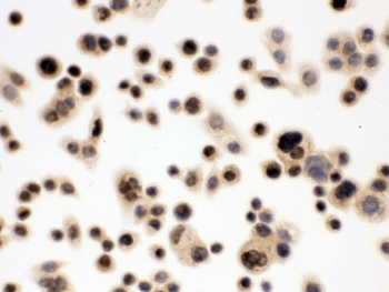 Polyclonal Rabbit anti-Human NBN / Nibrin Antibody (IHC, WB)