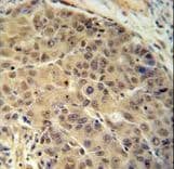 Polyclonal Rabbit anti-Human BUD13 Antibody (aa462-490, IHC, WB)