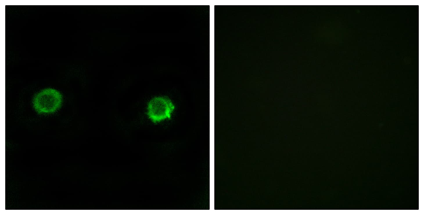 IHC-plus™ ABHD2 Antibody (aa251-300)