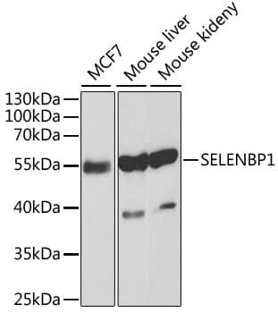 Selenium Binding Protein 1 Antibody