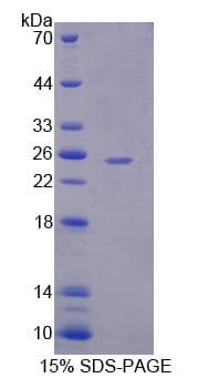 Human PDP2 Protein (Recombinant)