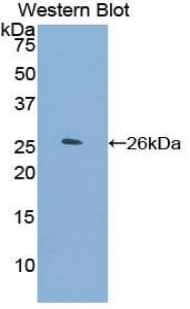 ORM2 / Orosomucoid 2 Antibody (aa19-207)