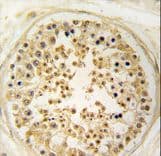 Polyclonal Rabbit anti-Human KIAA1970 / EARS2 Antibody (aa495-523, IHC, WB)