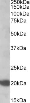 IHC-plus™ NRAS / N-ras Antibody (aa167-179)