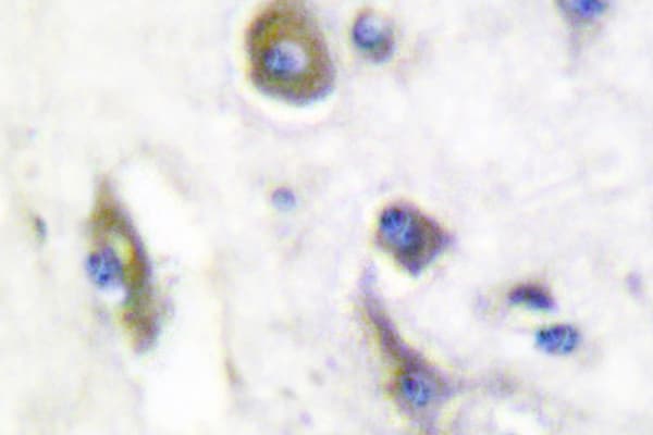 PARK2 / Parkin 2 Antibody (Gly12)
