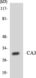 Polyclonal Rabbit anti-Human CA3 / Carbonic Anhydrase III Antibody (aa126-175, WB)