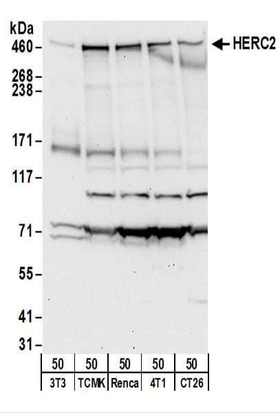 IHC-plus™ HERC2 Antibody (aa4784-4834)
