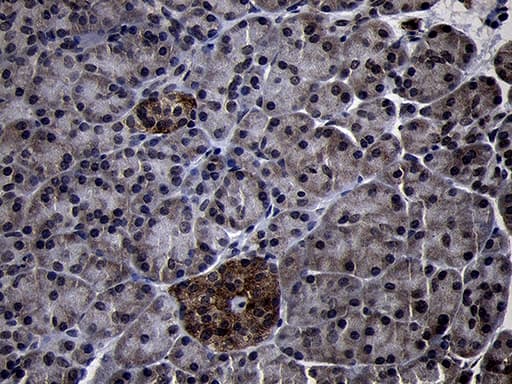 USP40 Antibody (aa767-912, clone OTI2C5)