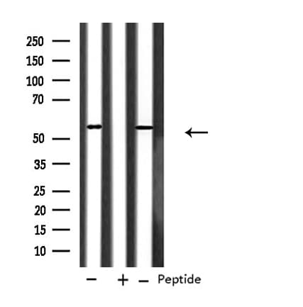 Polyclonal Rabbit anti-Human CYP2A6 Antibody (IHC, IF, WB)