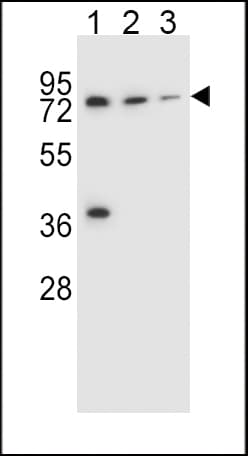 UGT2B15 Antibody (aa156-185)