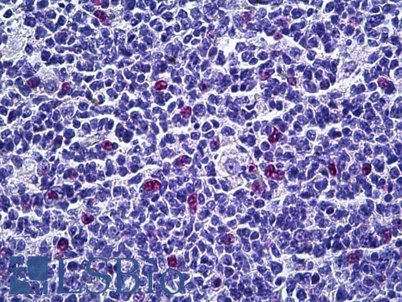IHC-plus™ Polyclonal Rabbit anti-Human AURKB / Aurora-B Antibody (aa198-247, IHC, IF, WB)