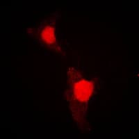 FOXO1 / FKHR Antibody (phospho-Ser319)