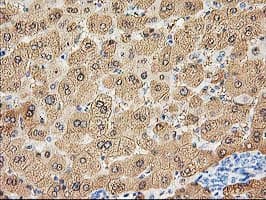ALDOB Antibody (clone OTI3E10)