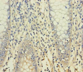 YPEL1 Antibody (aa1-119)