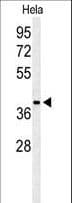 ADPRHL2 Antibody (aa87-114)