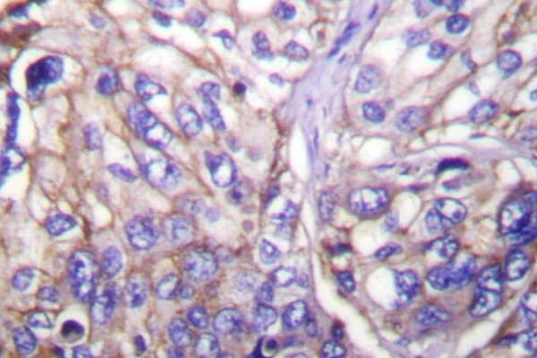 CLDN7 / Claudin 7 Antibody (Pro202)