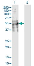 DDC / DOPA Decarboxylase Antibody (clone 8E8)