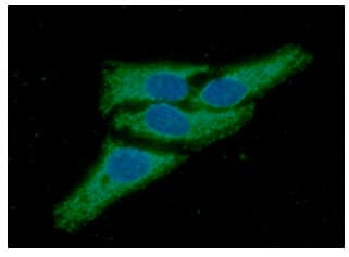 PRDX3 / Peroxiredoxin 3 Antibody (clone AT1F8)