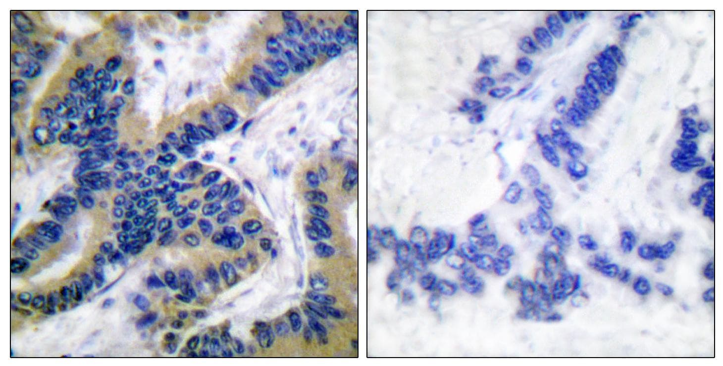 CASP6 / Caspase 6 Antibody (Cleaved-Asp179)