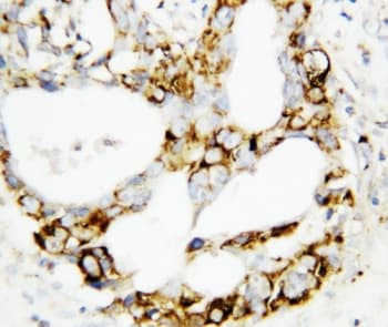 MAP2K3 / MEK3 / MKK3 Antibody (aa320-334)