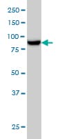 MAN1B1 Antibody (clone 6B1)