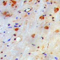 NME1 / NM23 Antibody (Internal)