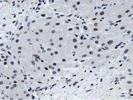 MSI1 / Musashi 1 Antibody (clone OTI3G4)