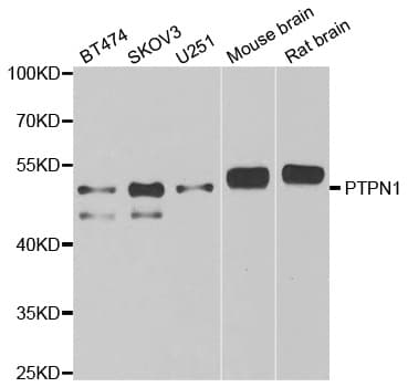 PTP1B Antibody
