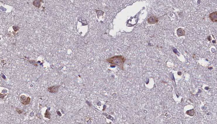 GLCNE / GNE Antibody