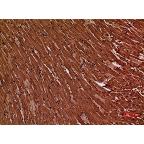 Polyclonal Rabbit anti-Human TNNT2 / CTNT Antibody (131-180 aa, Internal, IHC, WB)