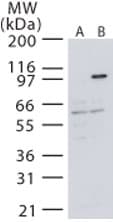 MAP3K14 Antibody (aa687-703)