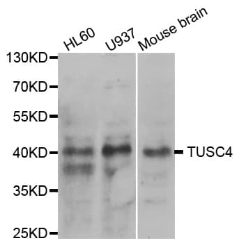 NPR2L / TUSC4 Antibody