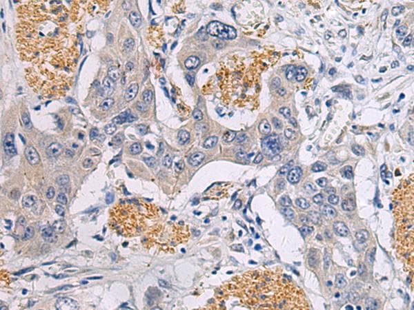 Polyclonal Rabbit anti-Human CHST3 Antibody (IHC)