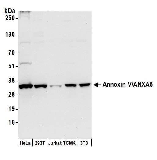 Polyclonal Rabbit anti-Human ANXA5 / Annexin V Antibody (aa100-150, WB)