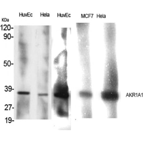 Polyclonal Rabbit anti-Human AKR1A1 Antibody (250-330 aa, C-terminal, WB)