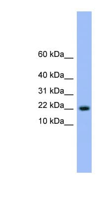 Polyclonal Rabbit anti-Human NXT1 Antibody (aa41-90, WB)
