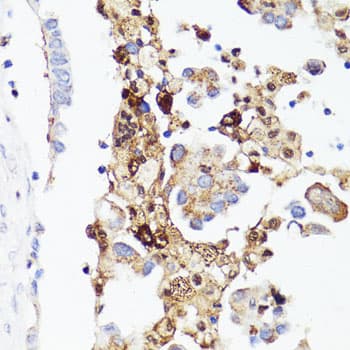 CD4 Antibody