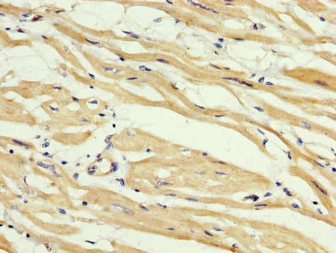 Polyclonal Rabbit anti-Human ABHD6 Antibody (IHC)