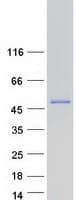 Human CCT7 Protein (Recombinant Myc-DDK (Flag))