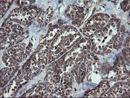 NDUFB9 Antibody (clone OTI3A1)