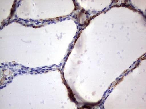 KRT19 / CK19 / Cytokeratin 19 Antibody (aa240-390, clone OTI1C11)