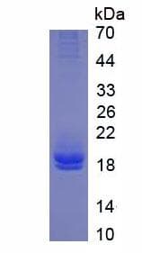 Human IL2 Protein (Recombinant His, N-Terminal)