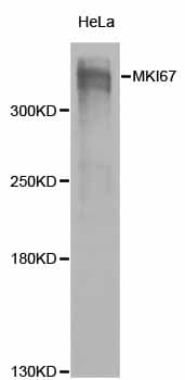 MKI67 / Ki67 Antibody